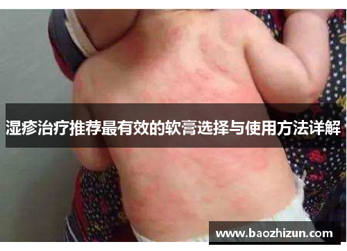 湿疹治疗推荐最有效的软膏选择与使用方法详解